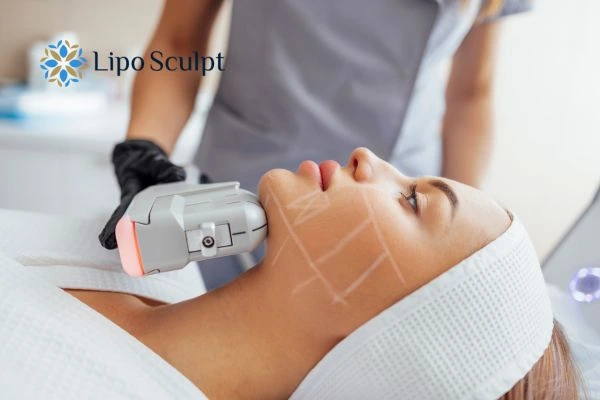 HIFU vs Botulinum Toxin: Understanding the Differences 1 HIFU vs Botox Wembley What is the best option for you?