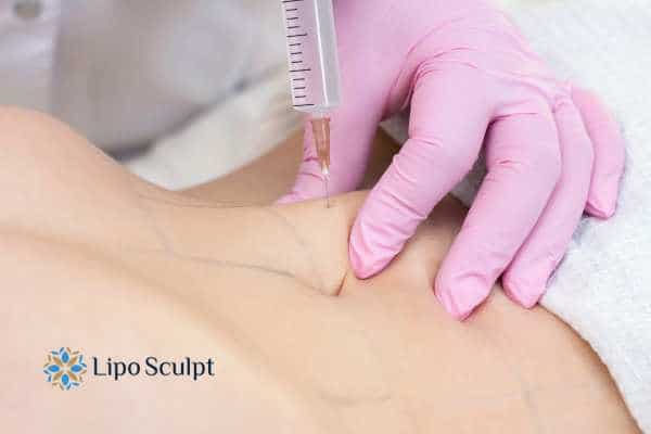 Aqualyx for Muffin Tops: What to Know Before Fat-Dissolving Injections 4 Are there risks Wembley?